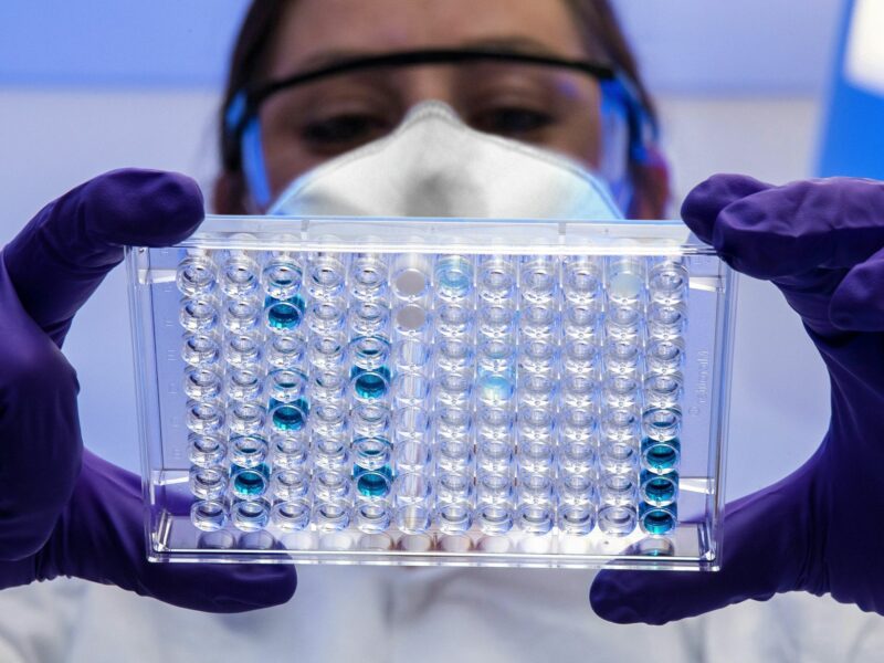 A scientists examines a tray of samples in a lab