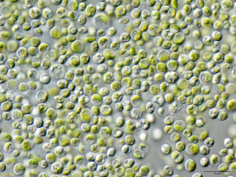 Micoscopic view of Chlorella vulgaris.