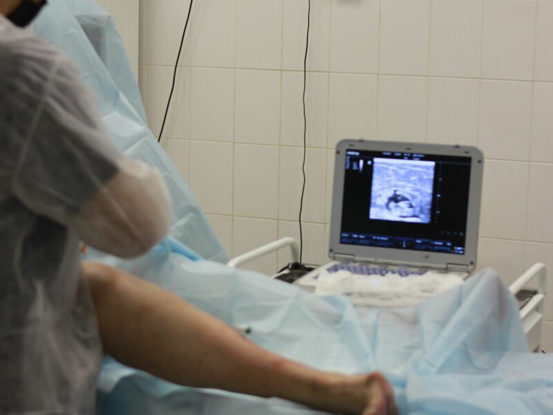 Photo of a person in a hospital getting an ultrasound