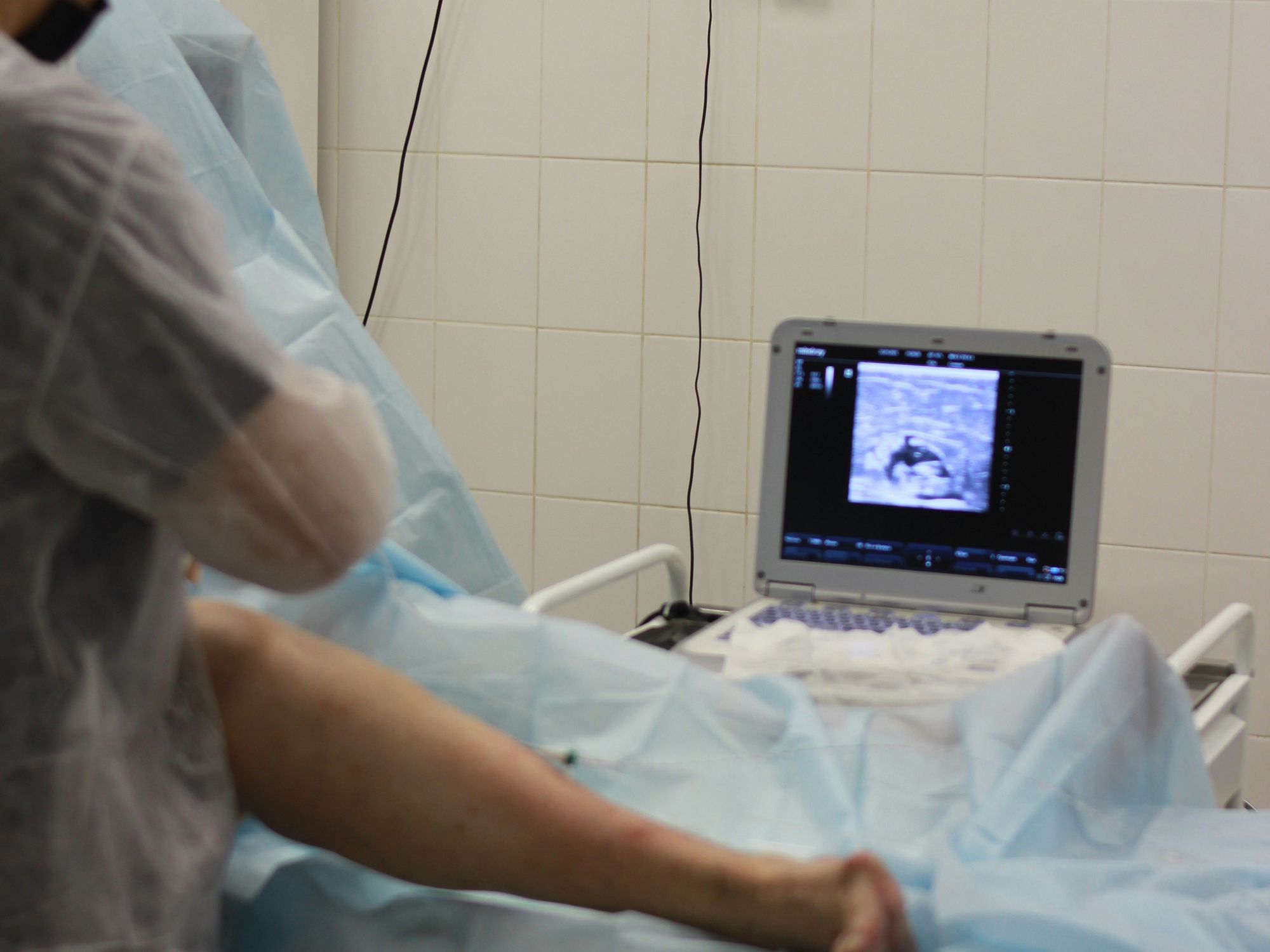 Photo of a person in a hospital getting an ultrasound