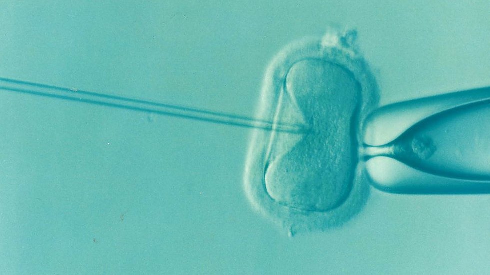 Photo of an IVF example