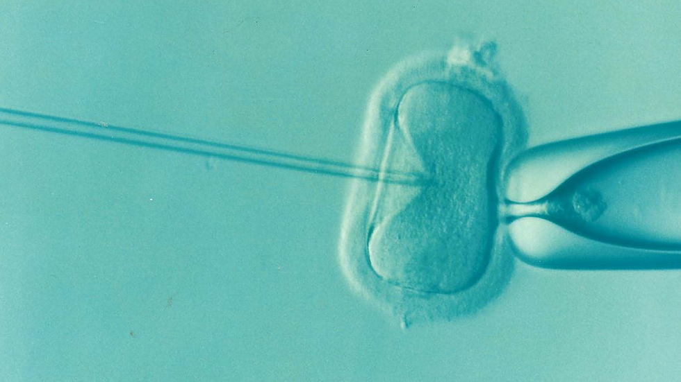 Photo of an IVF example