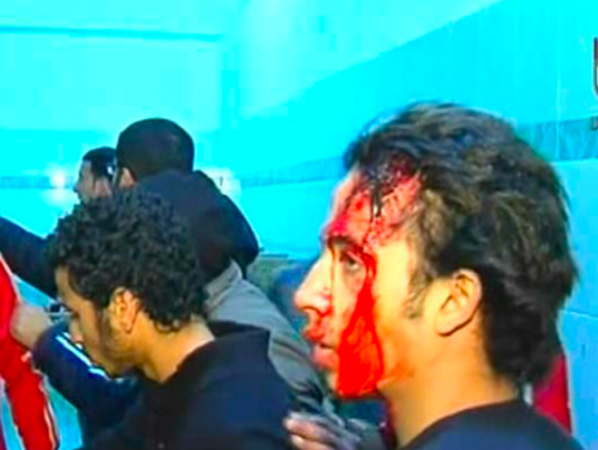 A bloodied fan after the Port Said match (Facebook)