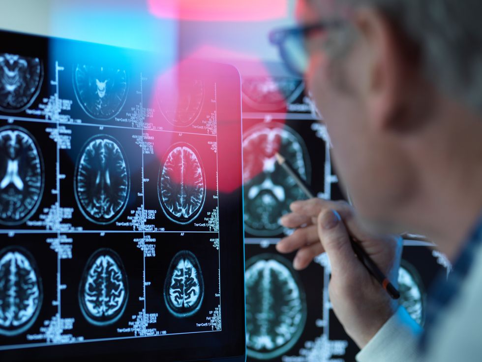 A doctor viewing brain scans for possible disease at a clinic in April 2019.