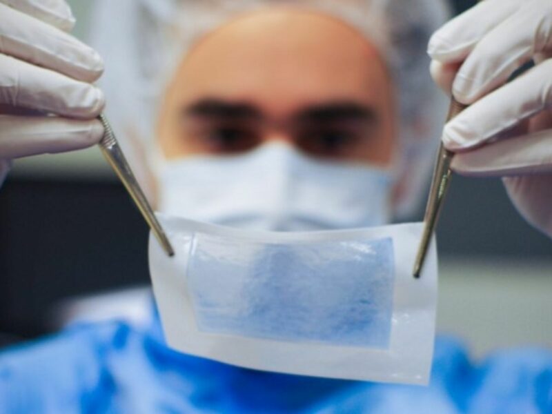 A lab worker for French company Poietis holds an example of 3-D printed skin