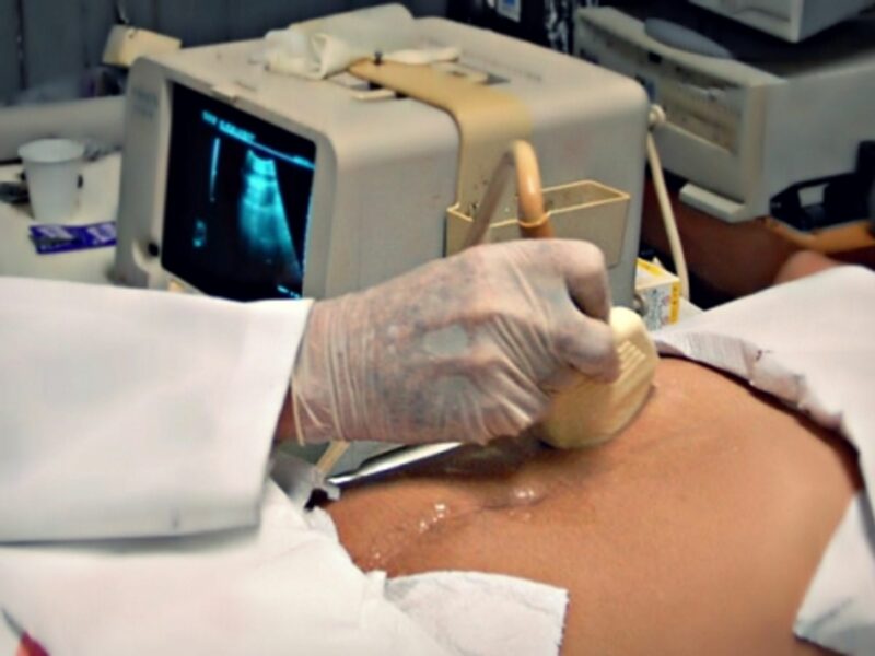 A New Feminist Argument Against Abortion