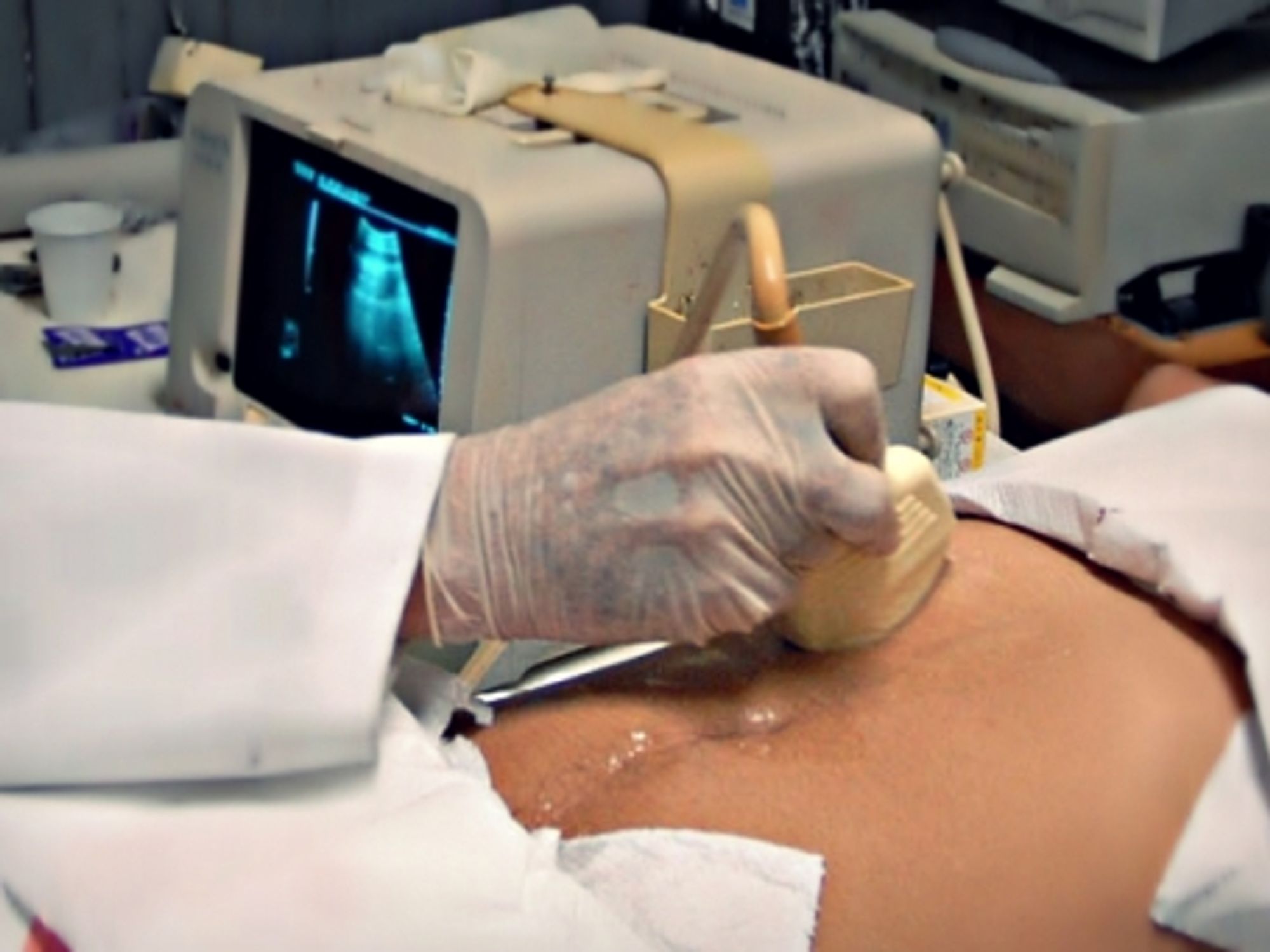 A New Feminist Argument Against Abortion