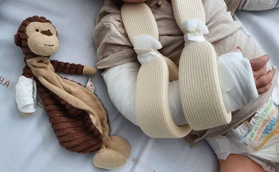 A photo of a baby with a broken arm in a caste.