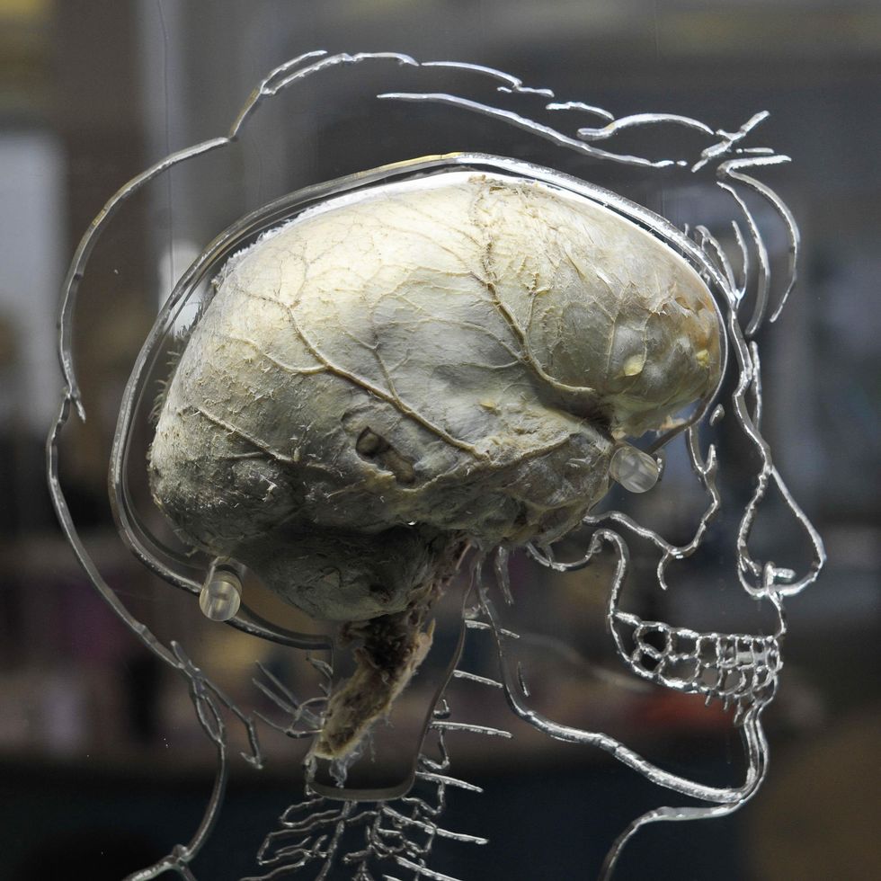 A real human brain suspended in liquid with a to-scale skeleton.