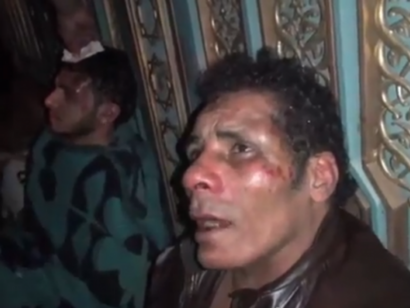 A video capture of two men in Cairo who say they were beaten by Muslim Brotherhood gangs last week