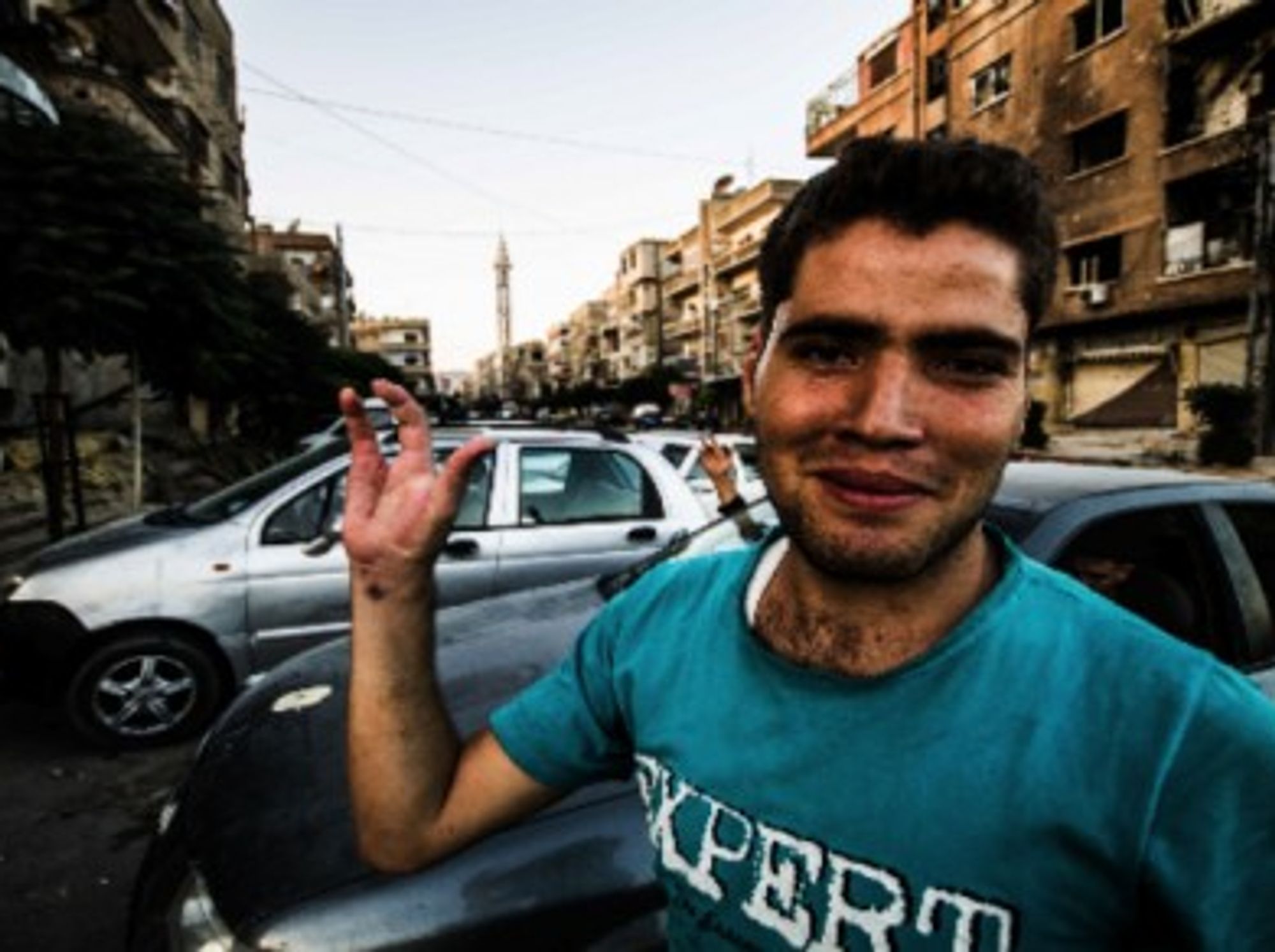 Abu Ali, an Free Syrian Army fighter, lost two of his middle fingers when he fired with an explosive bullet