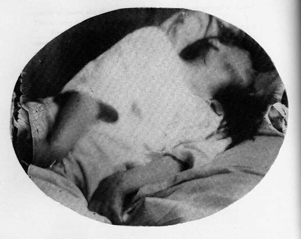 Black and white 1876 photo of a woman having a so-called "seizure from hysteria"