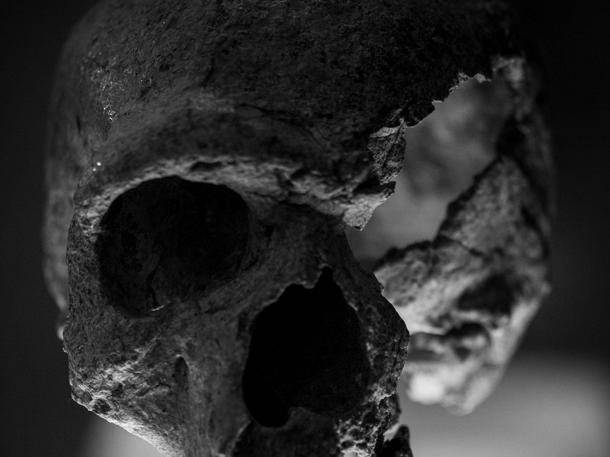 Black-and-white photo of a bashed in skull