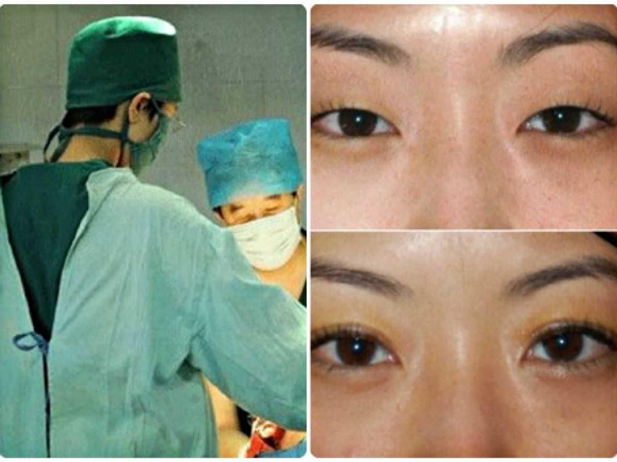China spends $2.5 billion a year on cosmetic surgery
