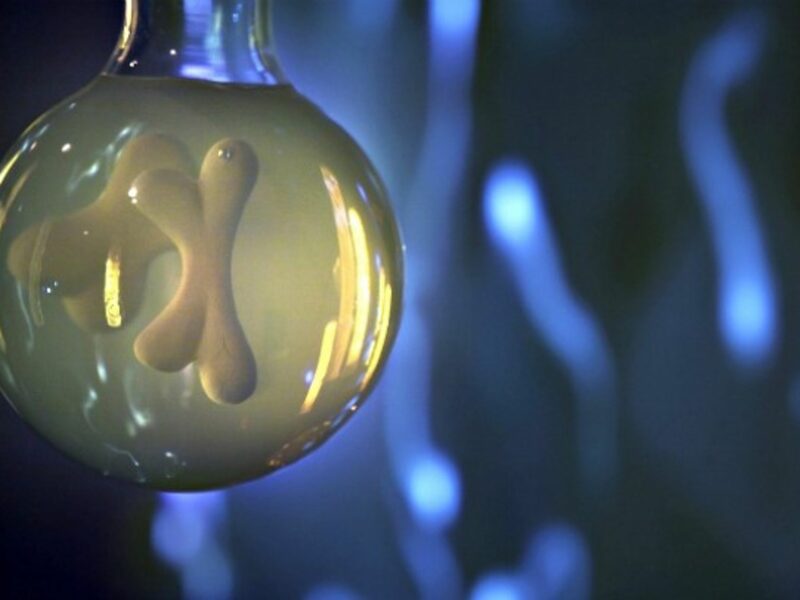 Detail of an epigenome.