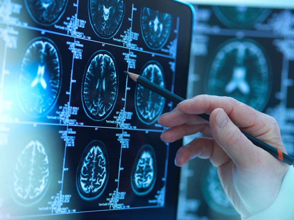 Doctor assessing brain scans for possible disease or damage