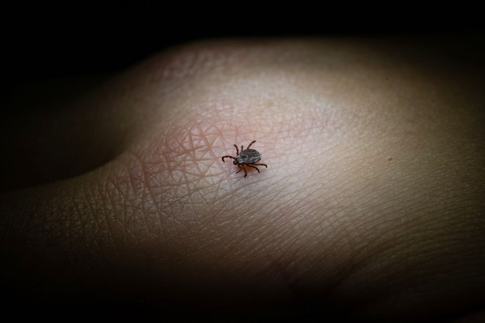 ​A member of the Parasitology Department at the University of Hohenheim shows a colored tick (Dermacentor reticulatus) in a laboratory.
