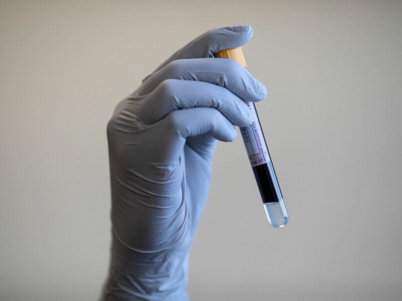 ​A paramedic holding a test tube containing a blood sample, United Kingdom, Aug. 7, 2024.