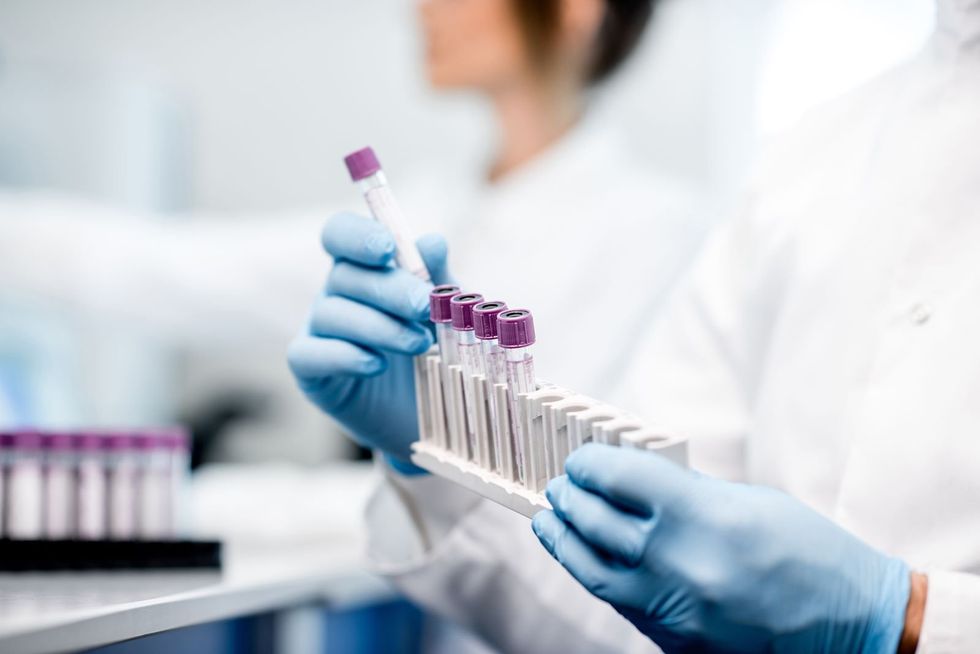 ​GRAIL announces the initiation of their first interventional study, where they will use our multi-cancer early detection test that was designed to detect all cancer types to guide clinical care for the first time, Feb. 18, 2020.