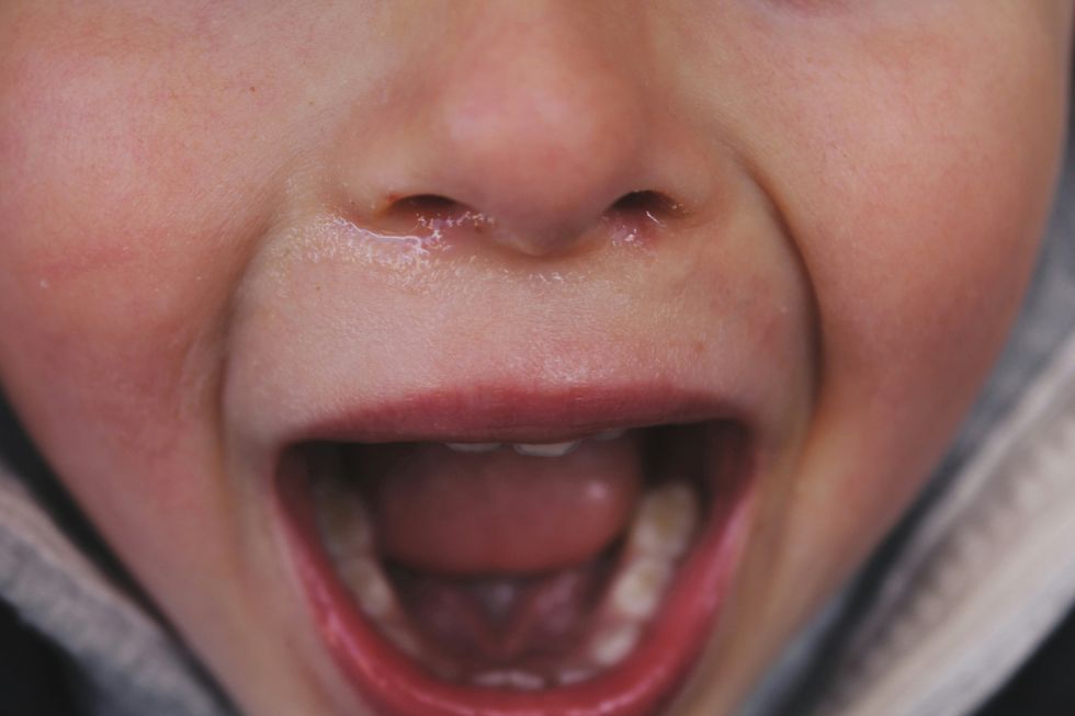 ​Young child opening their mouth in a scream, Feb. 8, 2019.