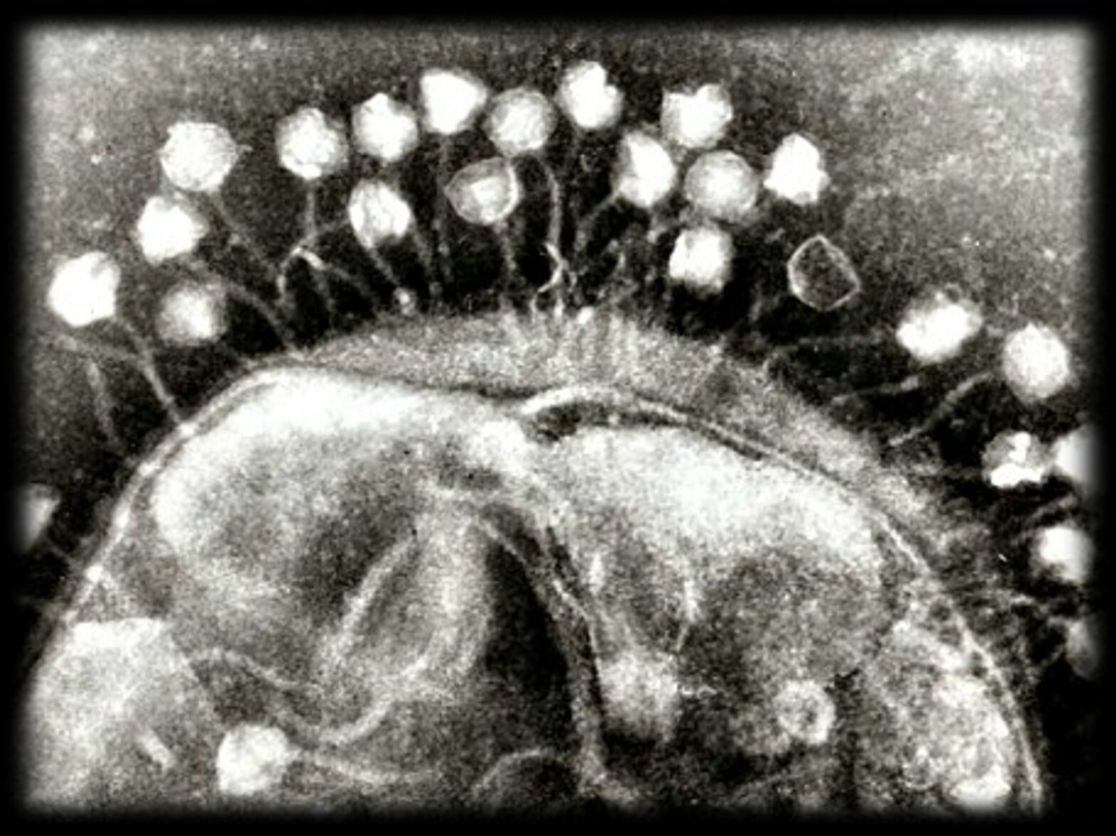 Electron micrograph of Bacteriophages