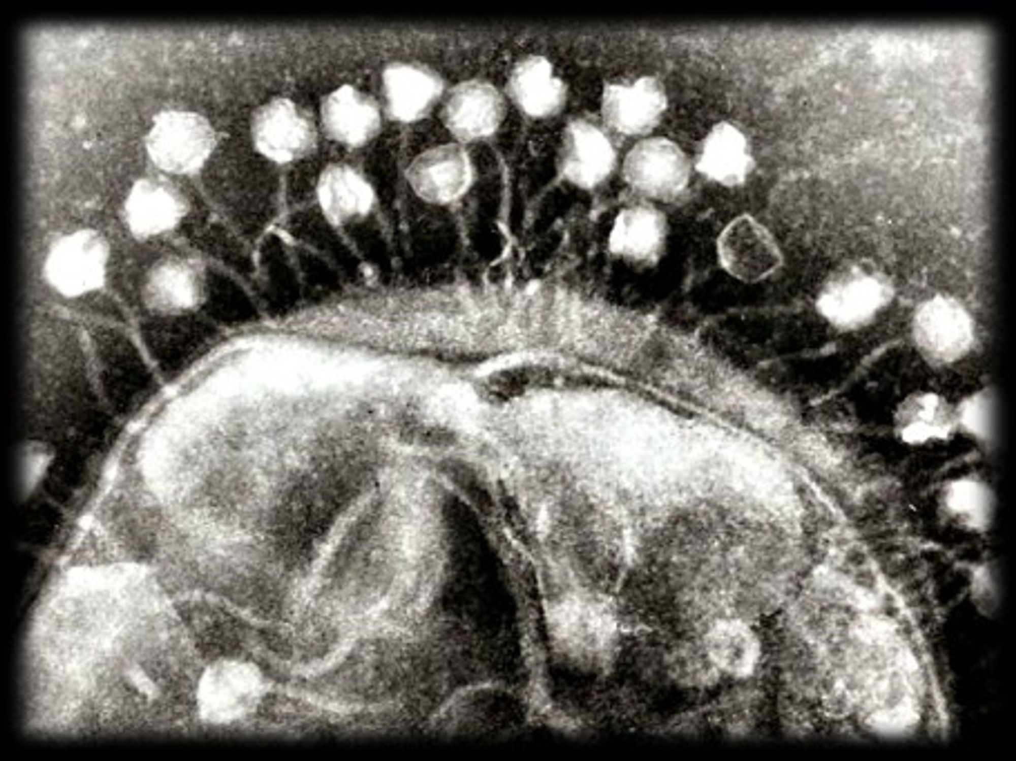 Electron micrograph of Bacteriophages