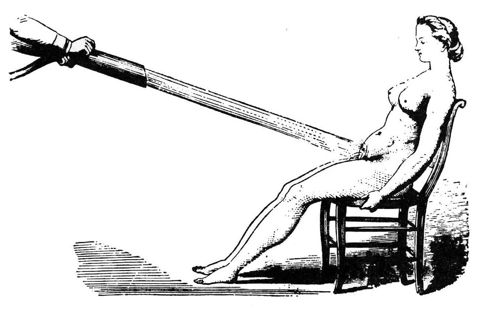 Female hysteria and such diseases were "healed" through the stimulation of the pelvic area, as shown in this illustration of a French pelvic douche in the 1860s.