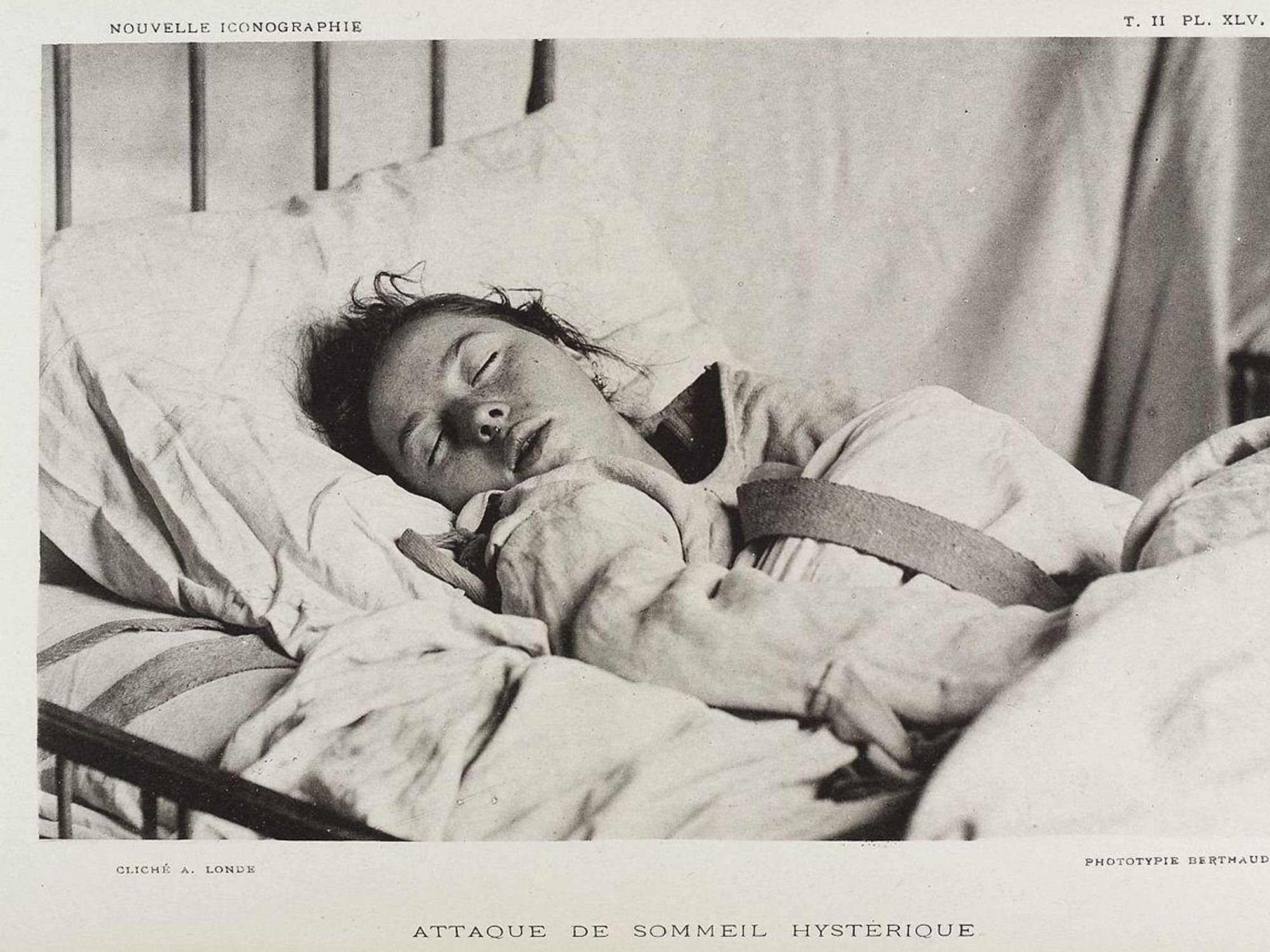 Hysterical To Hypersexual: Bogus Female Diseases Have Always Held Women Down