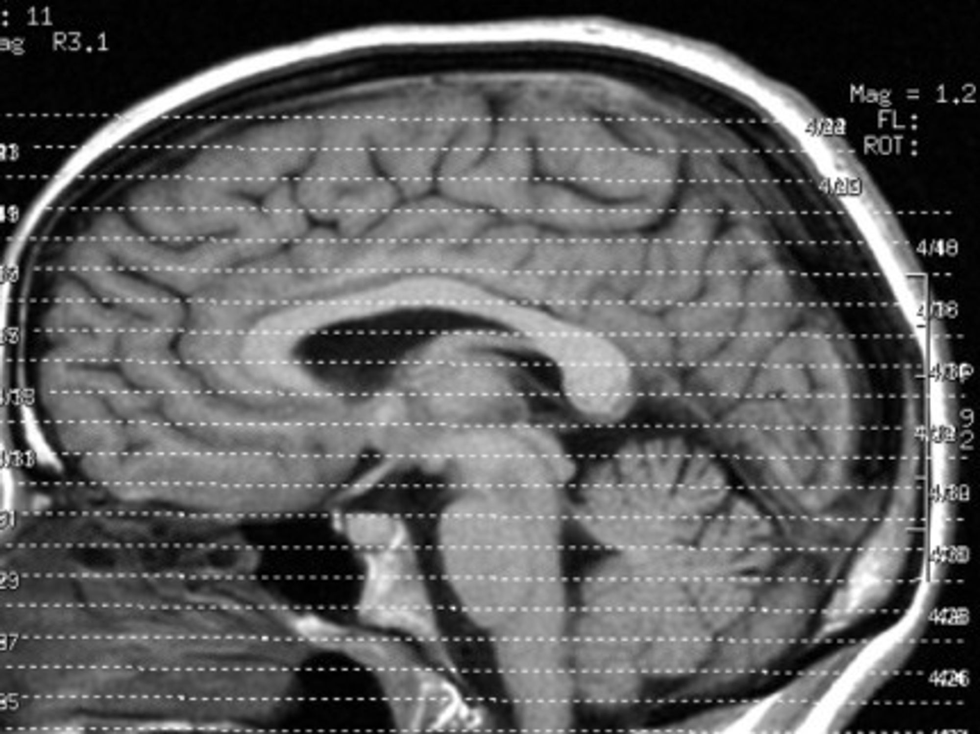 Human brains are relatively big and particularly dense