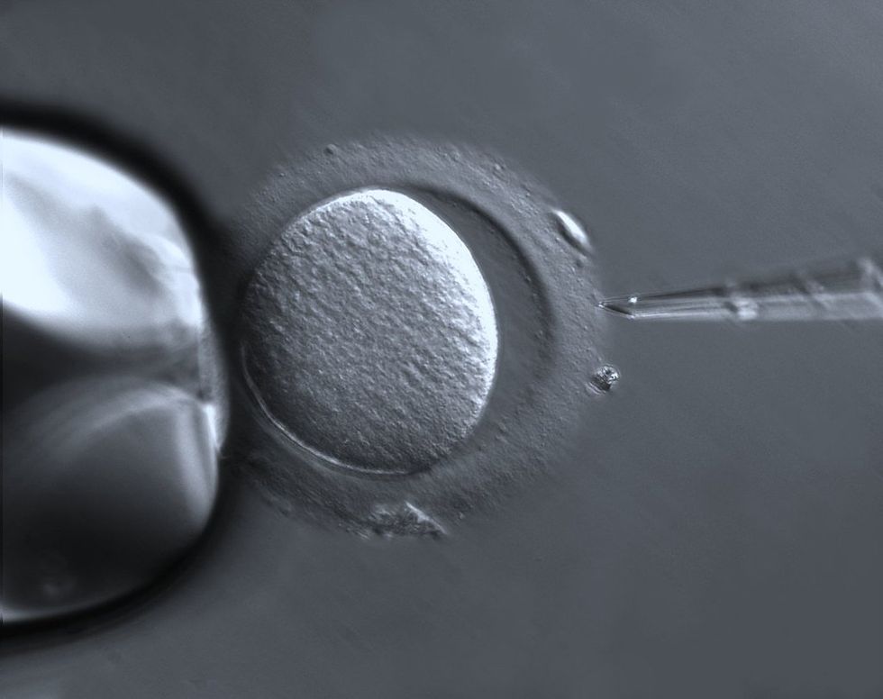 Image of egg cell and its membrane being approached by a sharp object