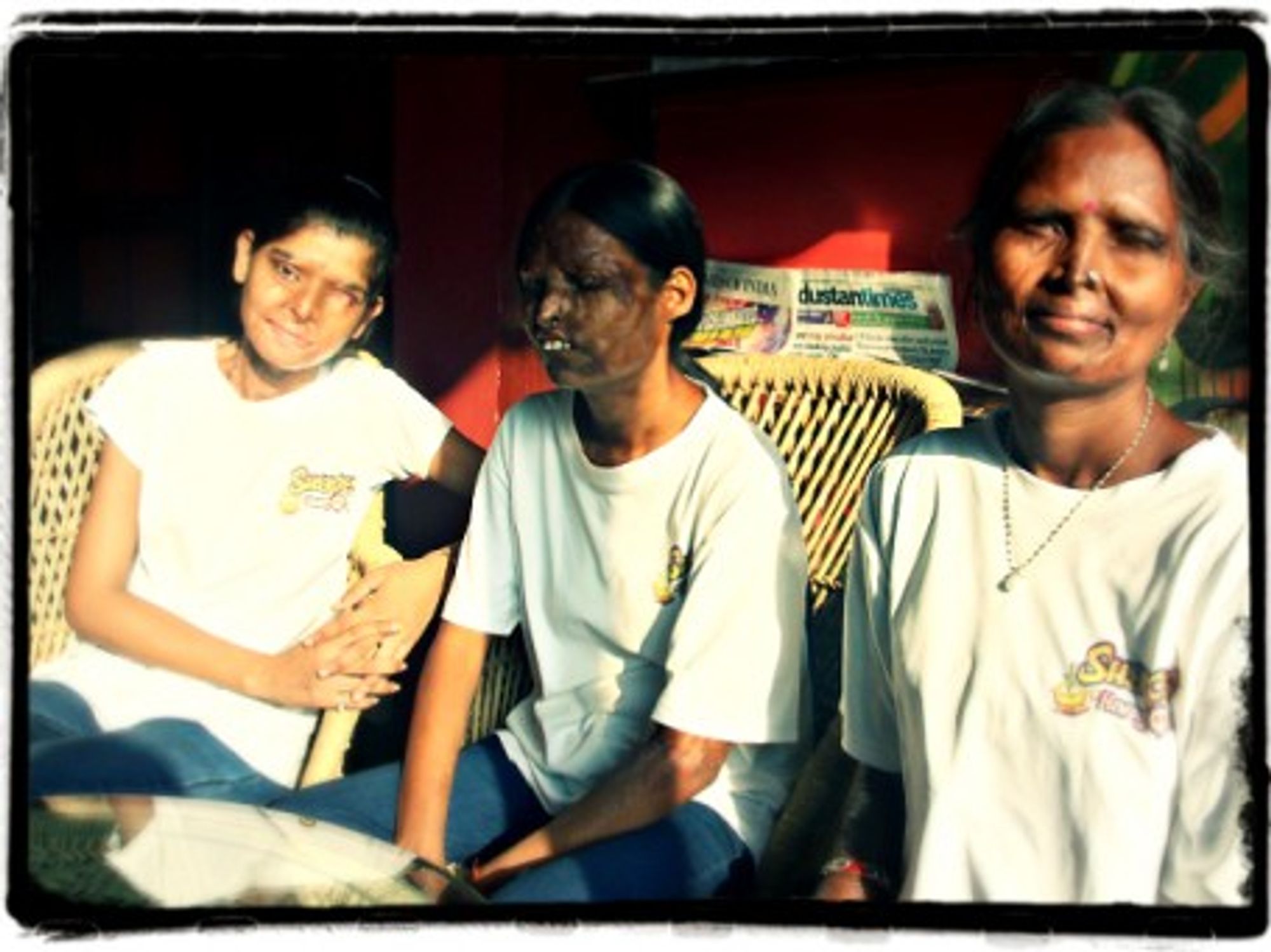 In India, A Cafe For Acid Attack Survivors Serves Pure Courage
