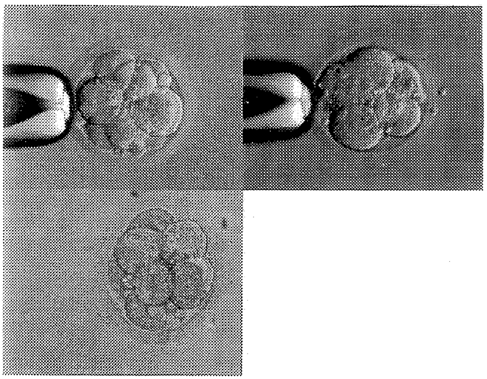 Magnified image of the author's parents' IVF