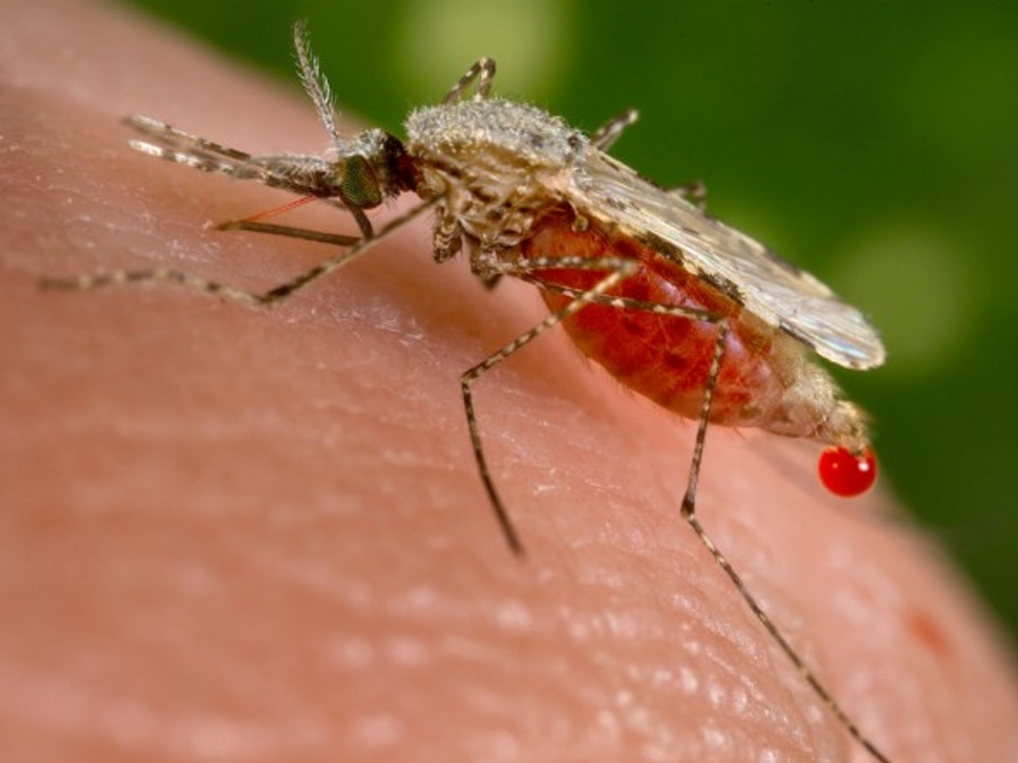 Malaria is Venezuela's latest struggle