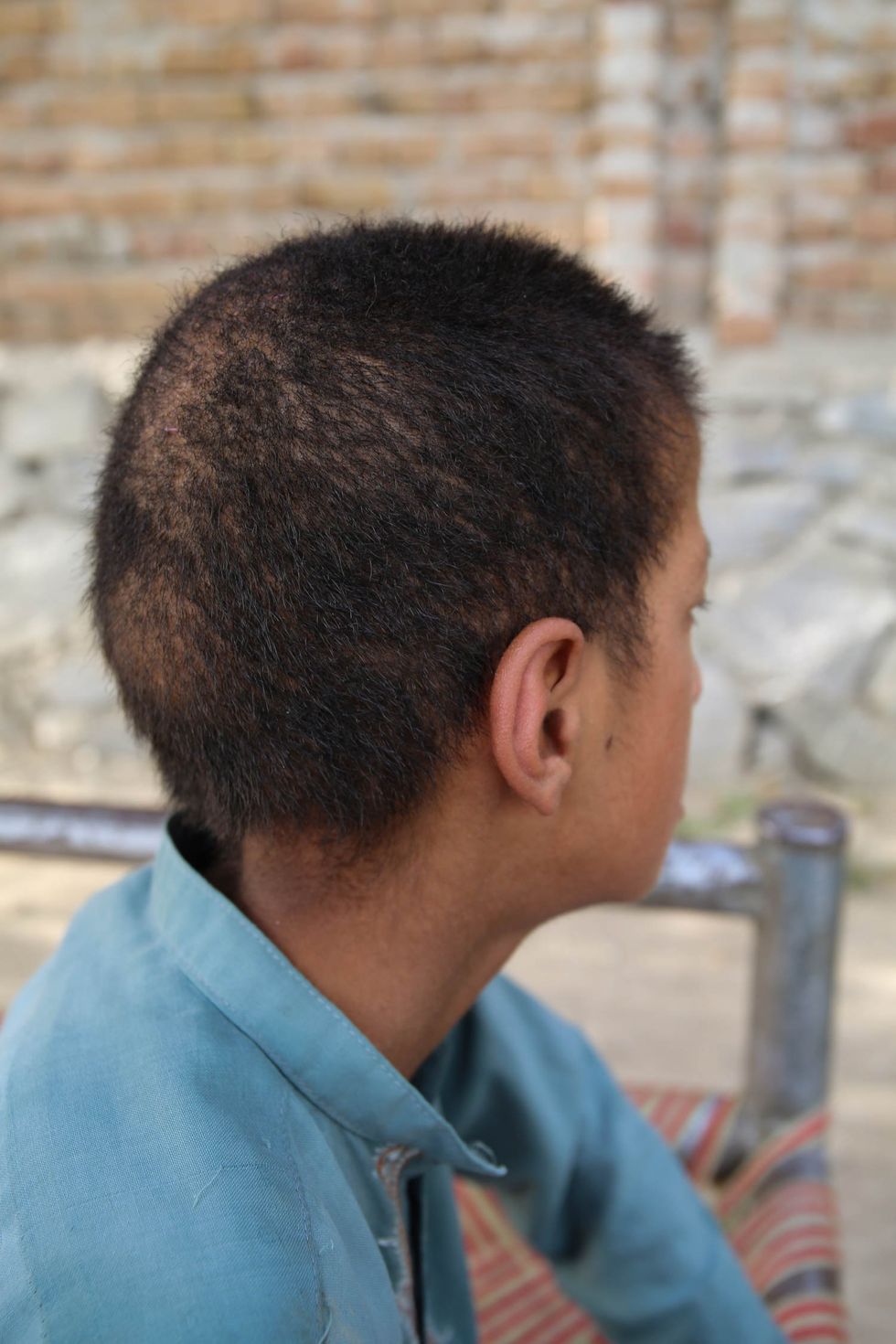 Mohammed Ajmal’s son, Mohammed Taha, 10, has a rash on his scalp which leaves bald itchy patches, and he has been ill since birth.
