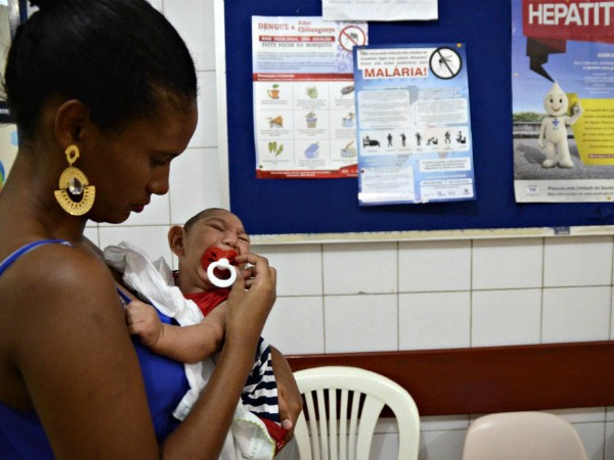 Mother and her baby born with microcephaly in Cabo de Santo Agostinho, Brazil