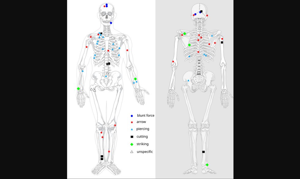 Patterns and locations of bone injuries as found with the Tollense valley dead.