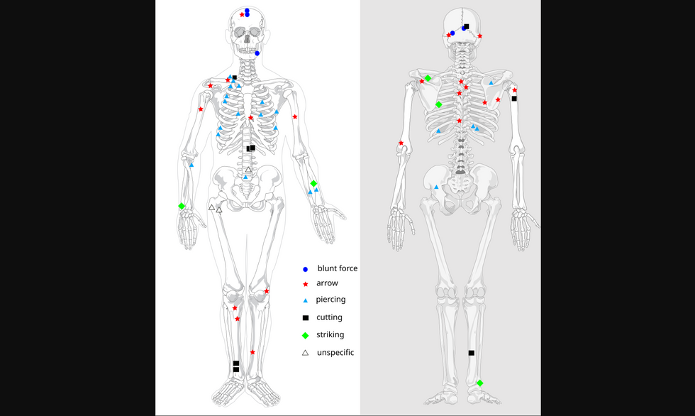 Patterns and locations of bone injuries as found with the Tollense valley dead.