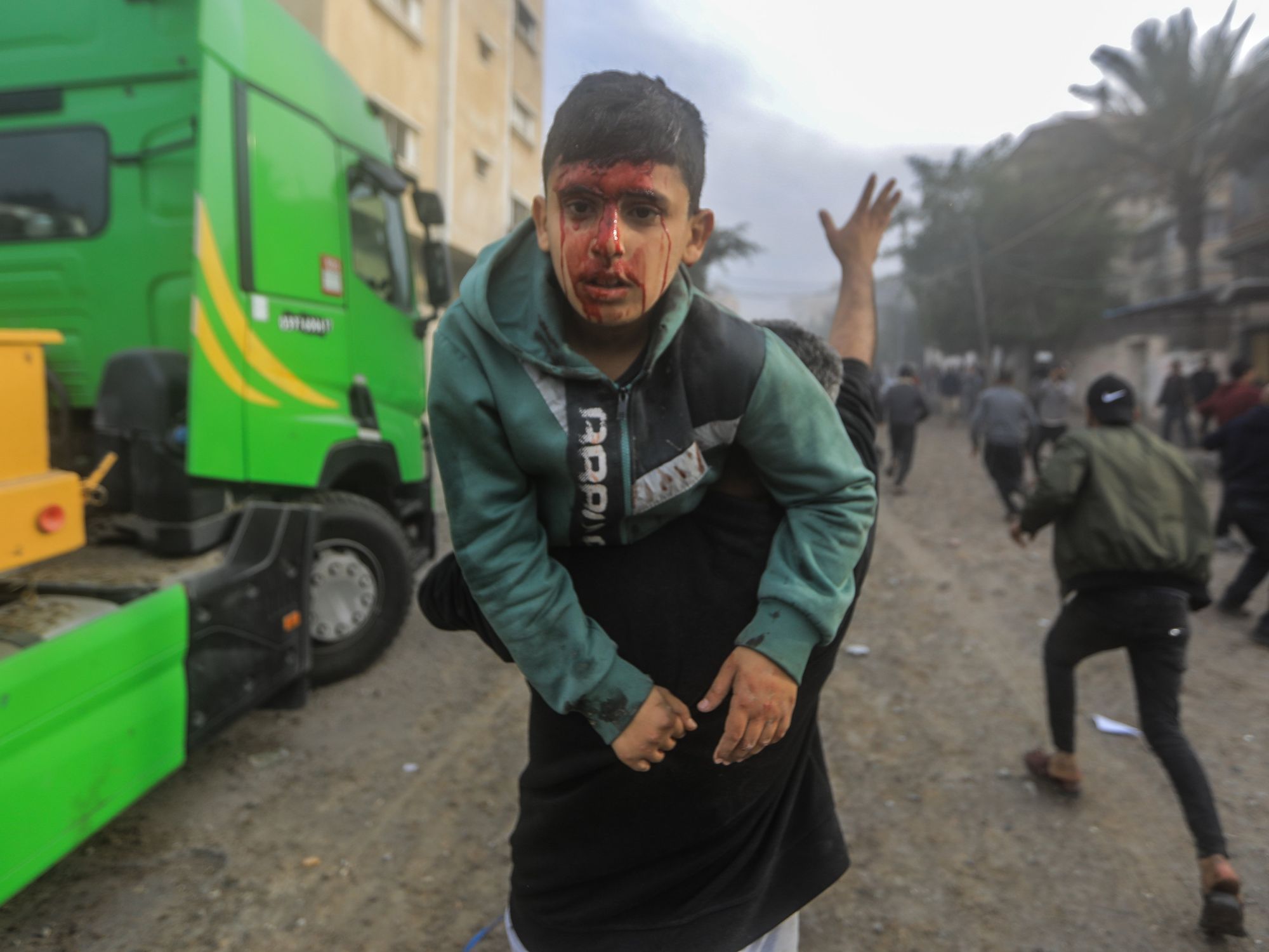 photo of a boy with blood on his face being carried by someone