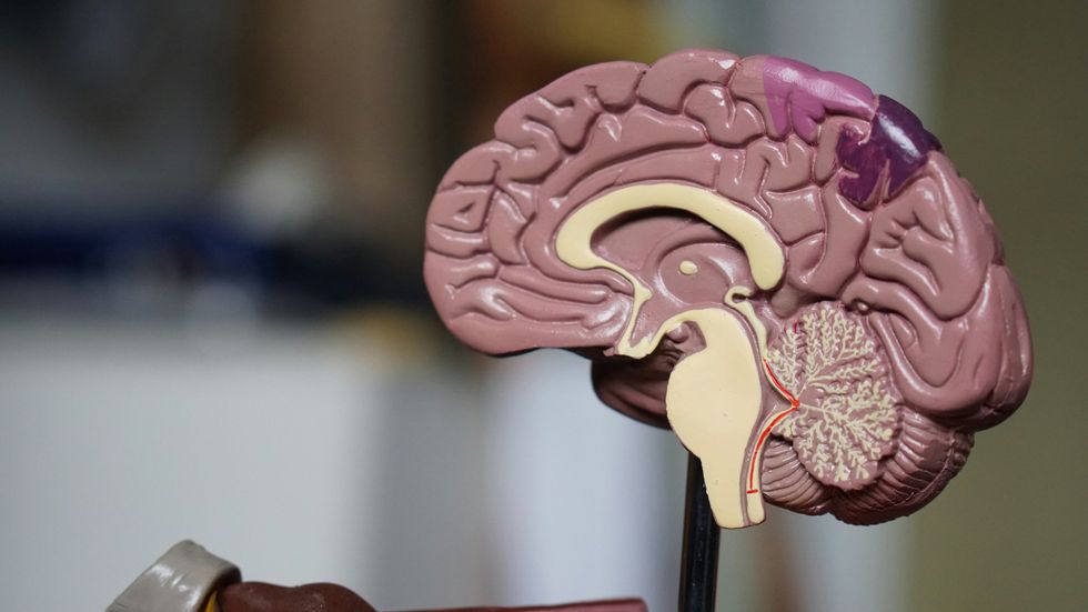 Photo of a brain diagram