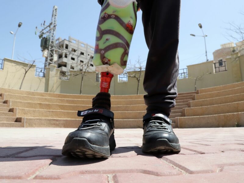 Photo of a child wearing a prosthetic leg in Gaza City