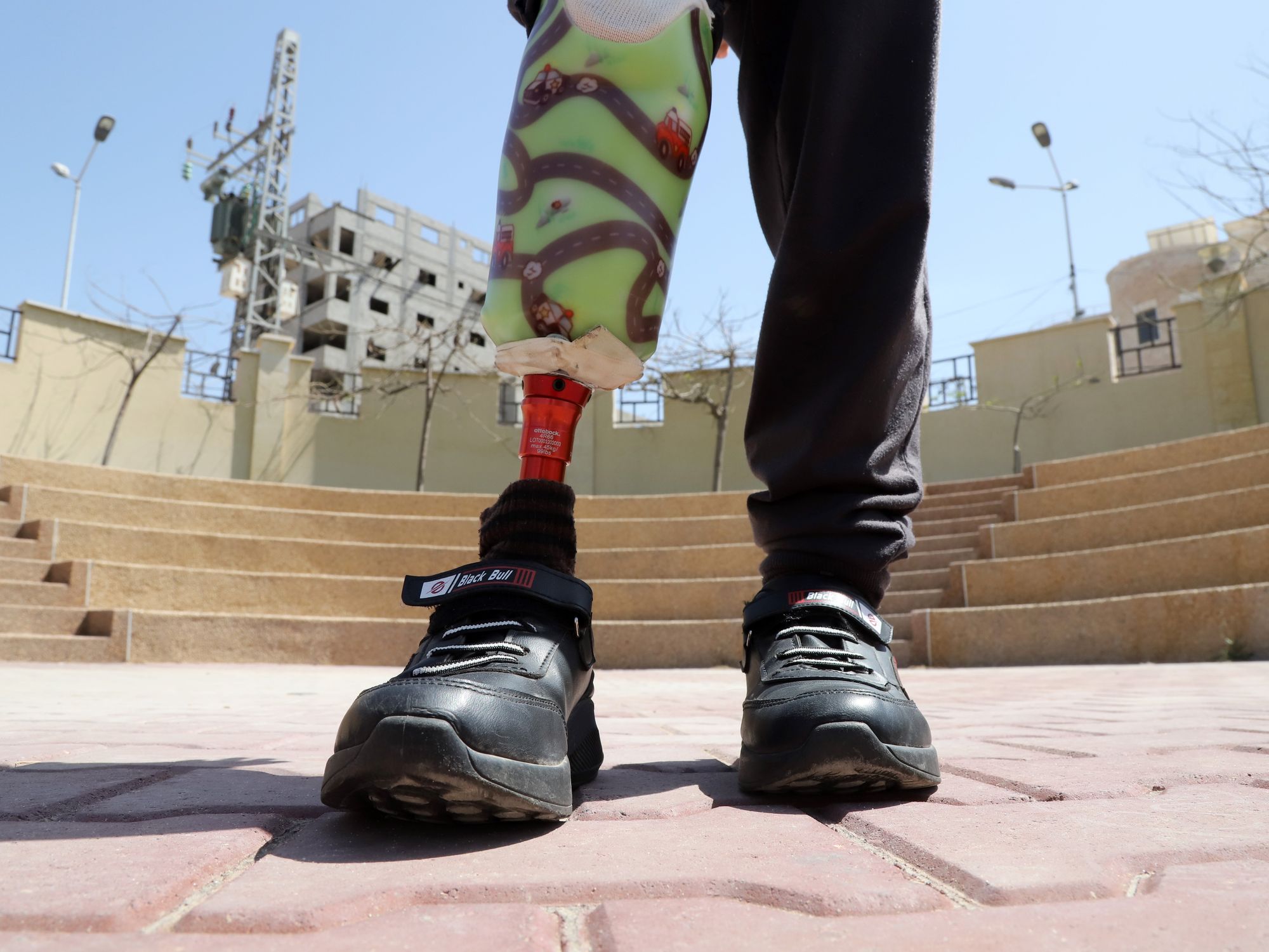 Photo of a child wearing a prosthetic leg in Gaza City