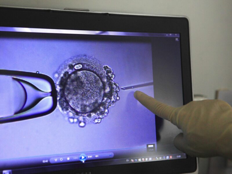 Photo of a doctor's hand pointing at a screen showing the fertilization process as part of an IVF procedure