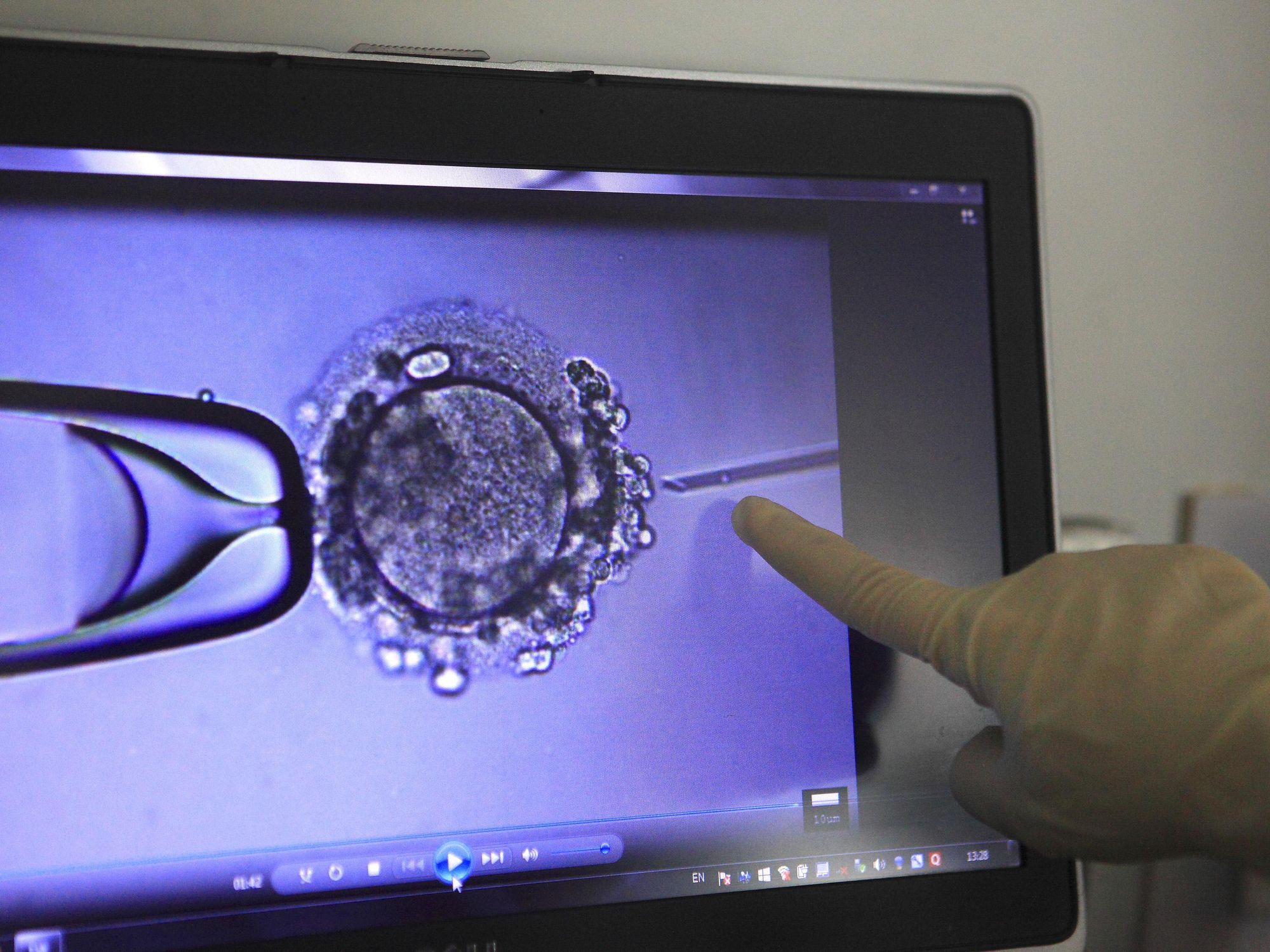 Photo of a doctor's hand pointing at a screen showing the fertilization process as part of an IVF procedure