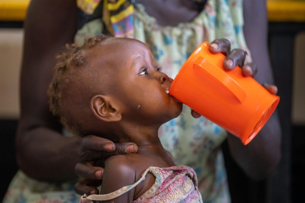 Photo of a malnourished todler drink a high-calorie formula in the malnutrition ward.