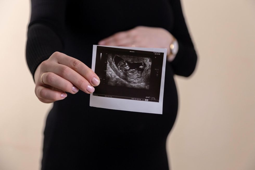Photo of a pregnant woman holding a sonogram