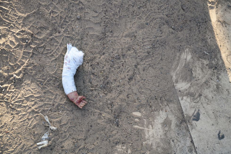 Photo of a severed doll's arm on the ground in Gaza on June 8