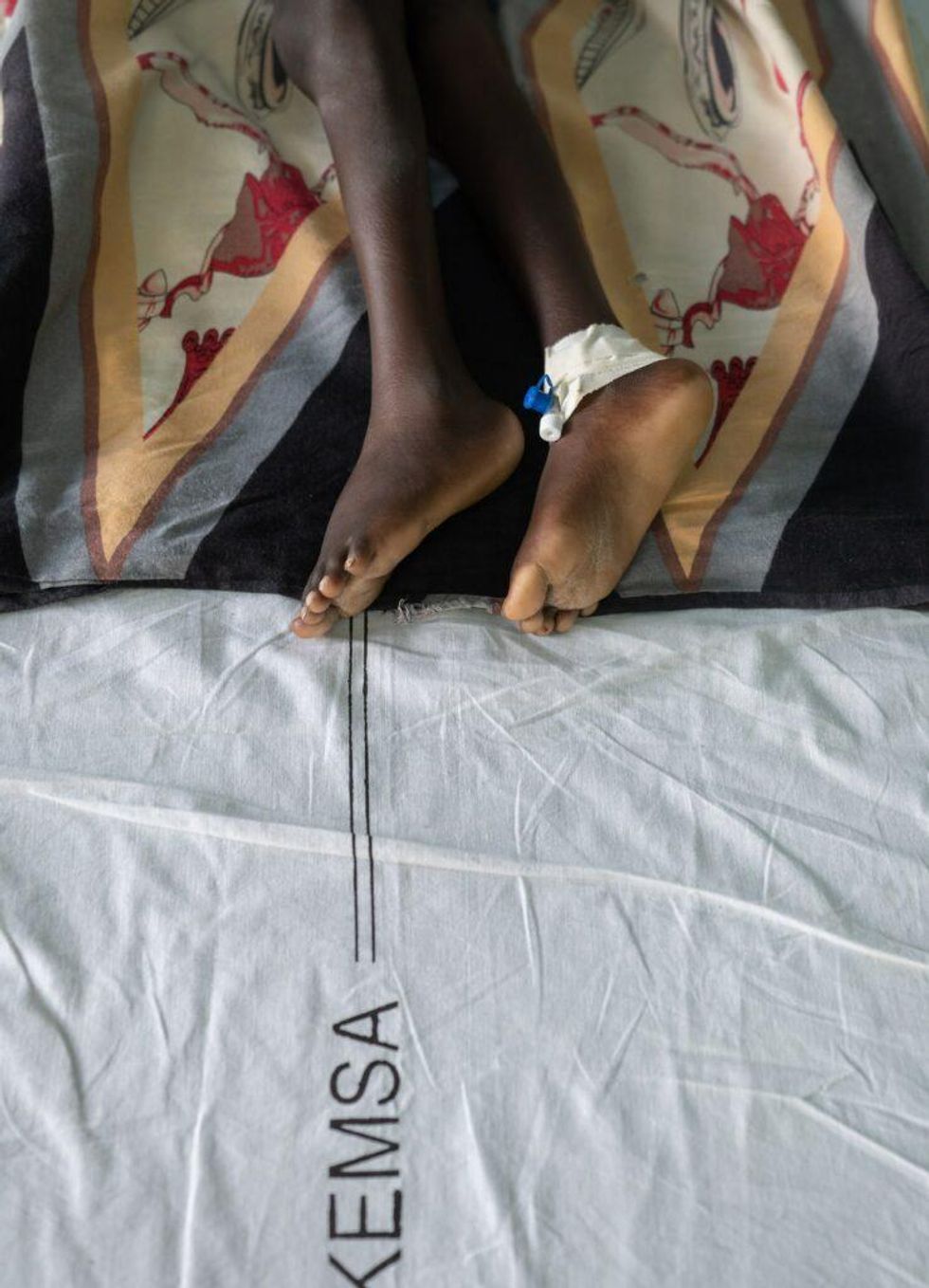 Photo of the feet of a malnourished child in a bed at the Ammusait General Hospital malnutrition ward