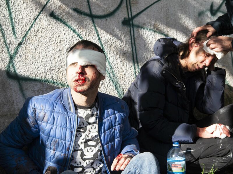 Photo of wounded civilians being treaeted in Kyiv on Oct; 10