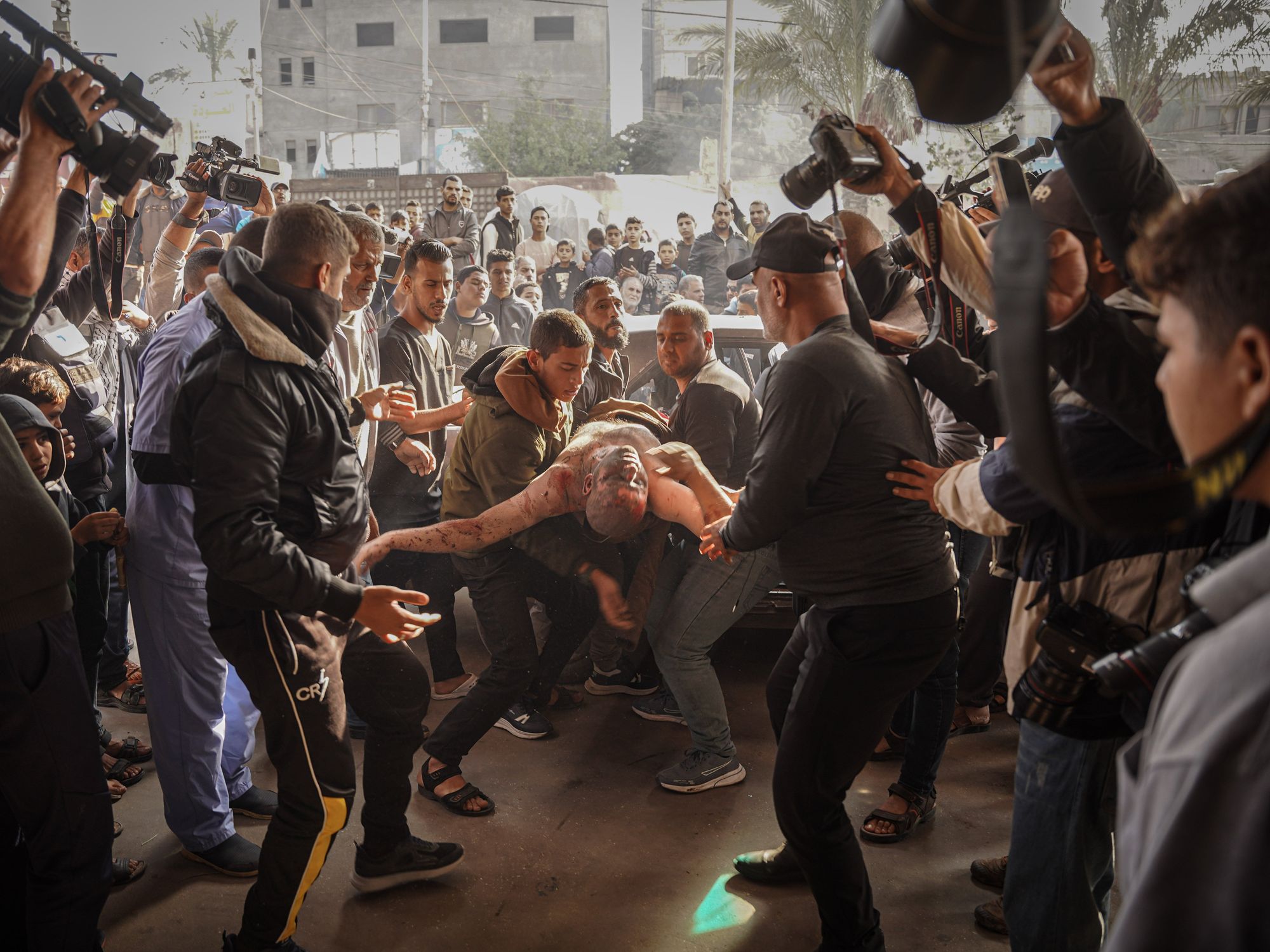 Photograph of Palestinians carry an injured man following the Israeli bombing on Khan Younis. They are surrounded by people and photographers.