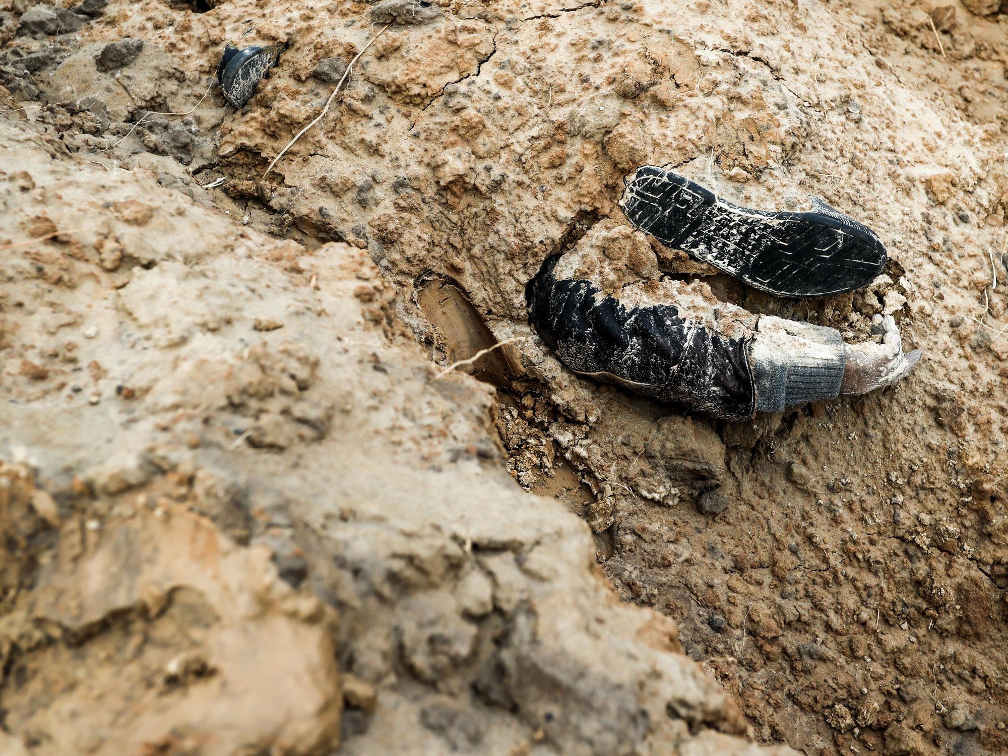 Picture of a buried corpse in Bucha